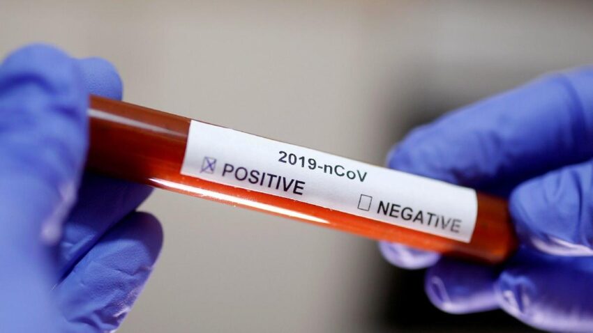 Bilim insanlarından korkutan Koronavirüs açıklaması