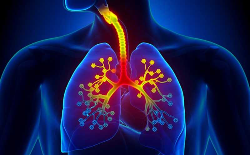 Bronşektazi: Nedir, Belirtiler, Nedenler ve Tedavi Nelerdir?